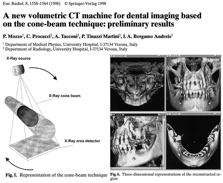 Dental cone beam CT